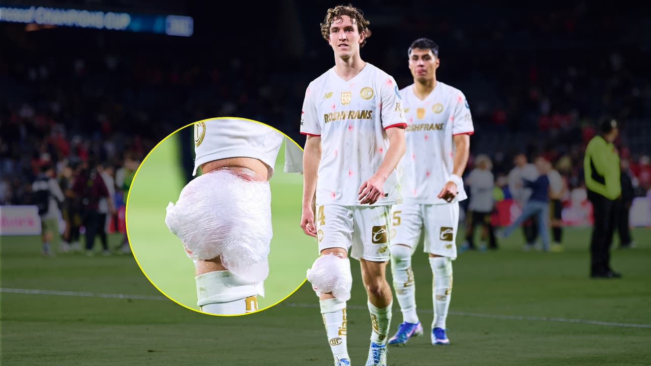 ¡Vuelve a encender las alarmas! Marcel Ruiz sale con la rodilla envuelta en hielo