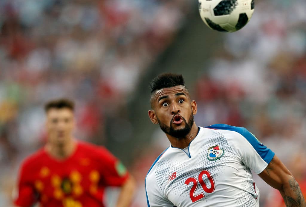 Anibal Godoy de Panamá. El jugador panameño parece que escogió su corte de pelo basado en el señor cabeza de pasto.