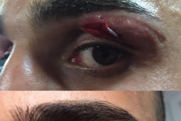 Malignaggi pospusó pelea por lesión (Foto: Twitter).