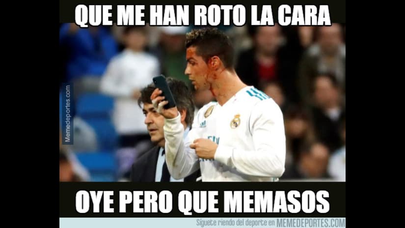 ¿Te das cuenta que estás descalabrado y tu primera reacción es ver tu reflejo en un celular? ¡Eso fue lo que hizo Cristiano Ronaldo y los memes no lo perdonaron!