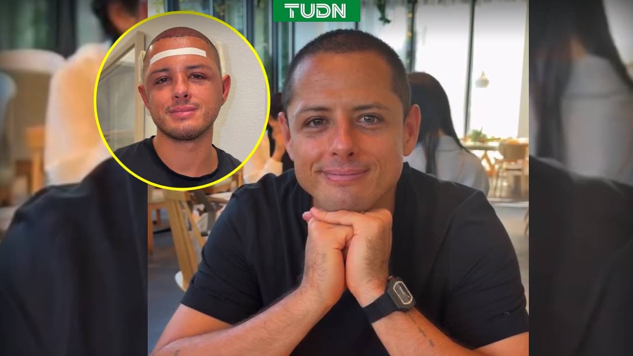 Chicharito Hernández revela detalles de su injerto de cabello