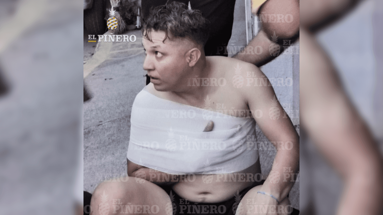 Así terminó un futbolista amateur que no hizo caso a la cuarentena y terminó lesionado, ocurrió en Oaxaca, México.