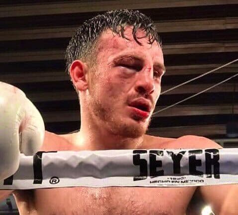 Así quedó el hijo de Julio César Chávez tras perder con Ortiz