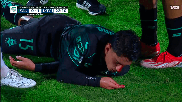 ¡Durísimo golpe! Berterame con un codazo accidental a Naveda