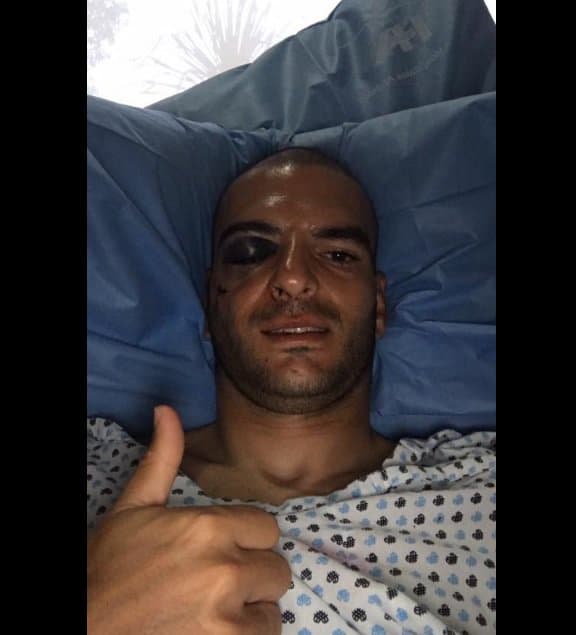 Afortunadamente, el aparatoso encontronazo quedó nada más en una fractura de pómulo: volverá a jugar.