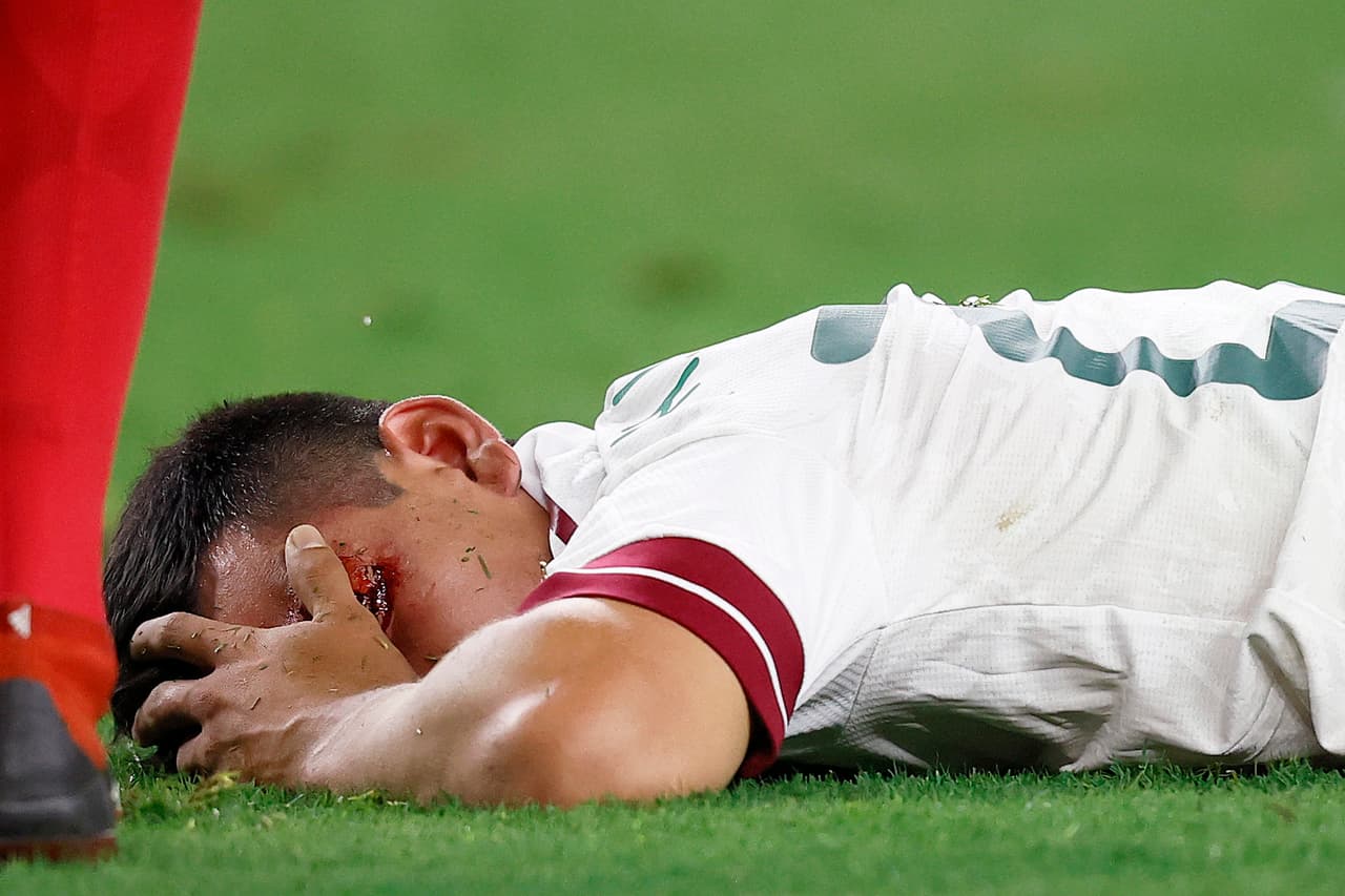 Chucky Lozano deja hospital con esguince; no requirió cirugía