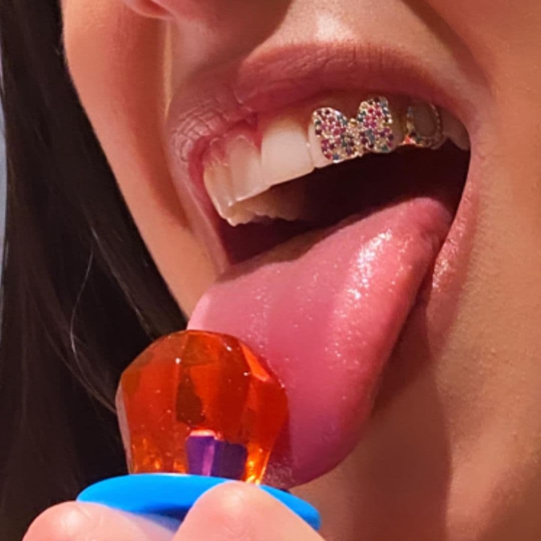 Madonna y Dua Lipa ya han brillado en público portando orgullosas sus costosas piezas dentales.