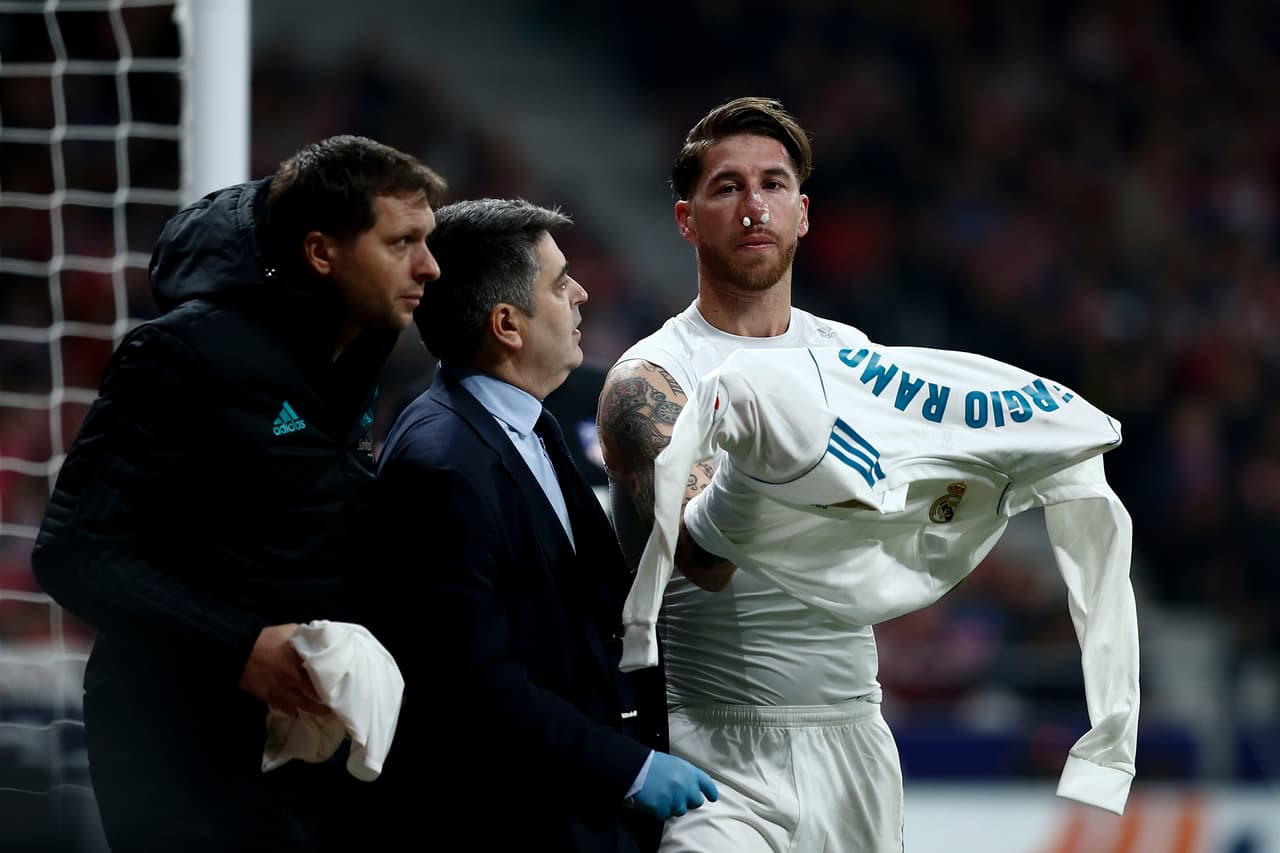Confirman fractura de nariz de Sergio Ramos