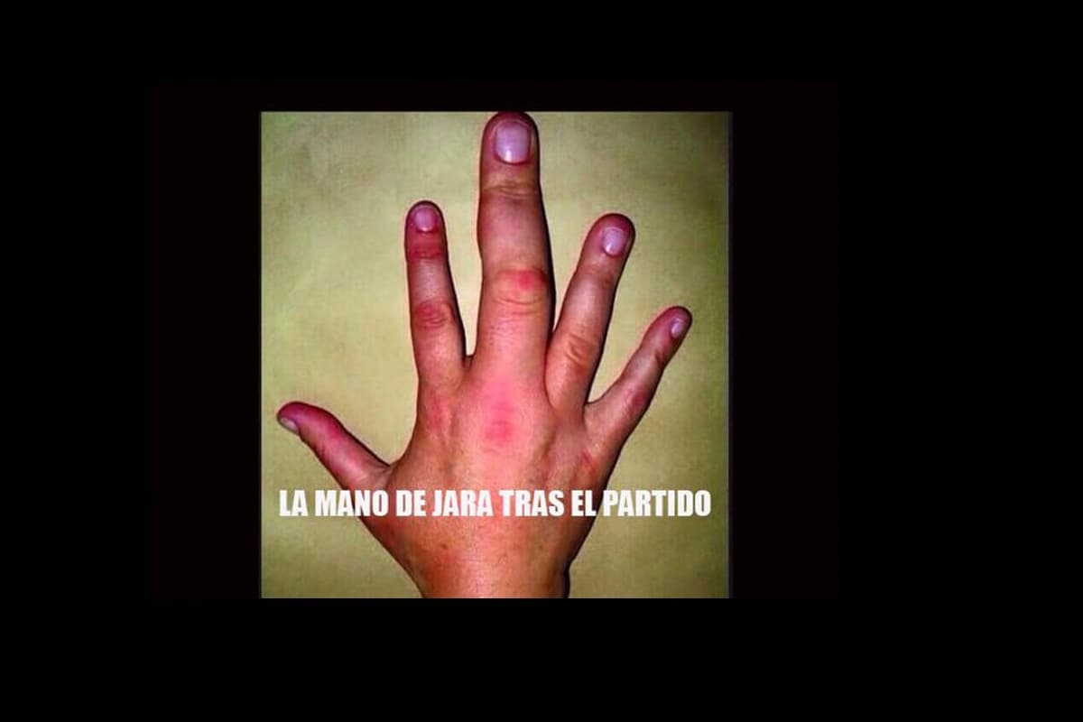 Mira los mejores memes del 'dedazo' de Gonzalo Jara a Edinson Cavani en el partido Chile-Uruguay en cuartos de final de la Copa América 2015 (Twitter).