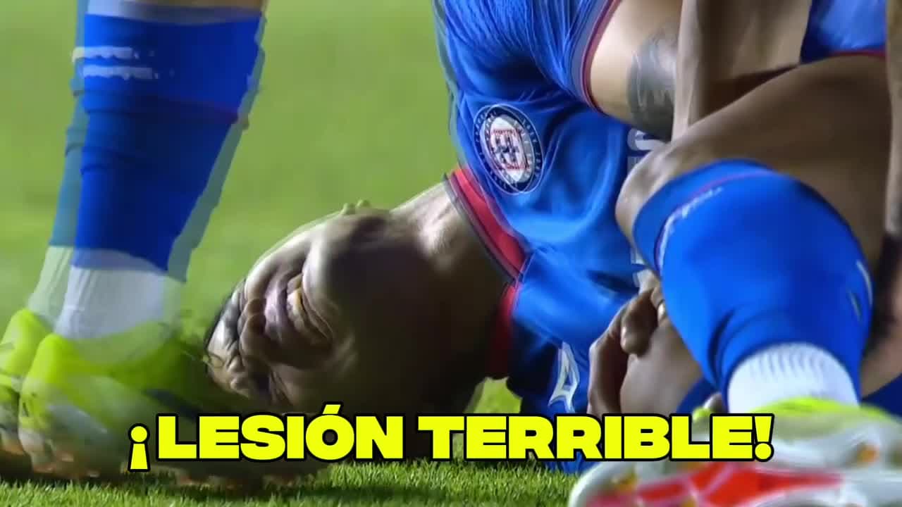 ¡Muy triste lesión que asusta a todos en Cruz Azul!