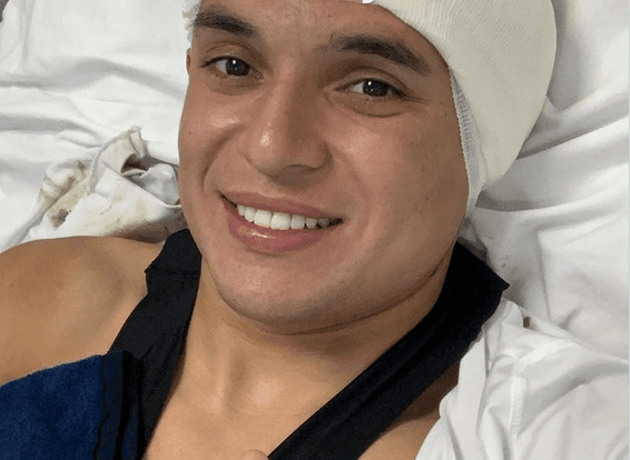 Arturo Paganoni, del Puebla, sufre una fisura en el cráneo