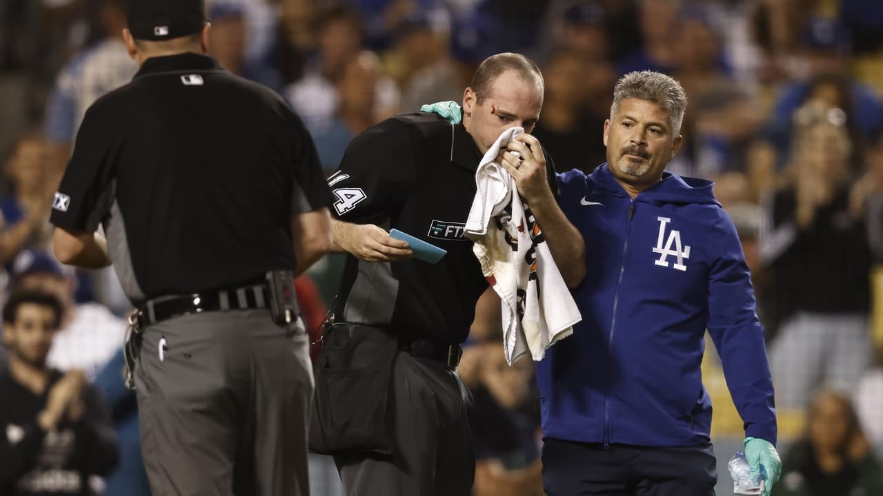 Un umpire es golpeado con un bat roto de forma accidental
