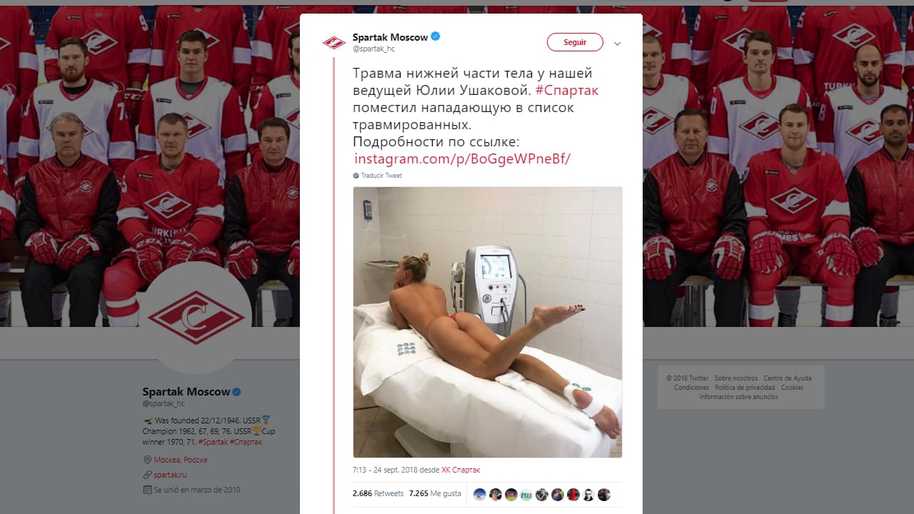 De modo inusual, el Spartak de Moscú dio a conocer lesión de Yulia Ushukova
