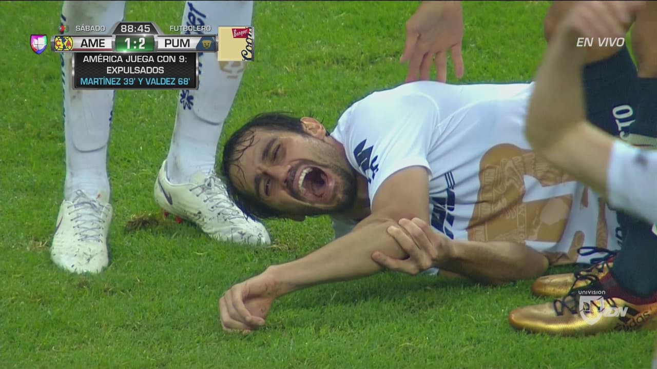 Alejandro Arribas será baja para Pumas por al menos un mes