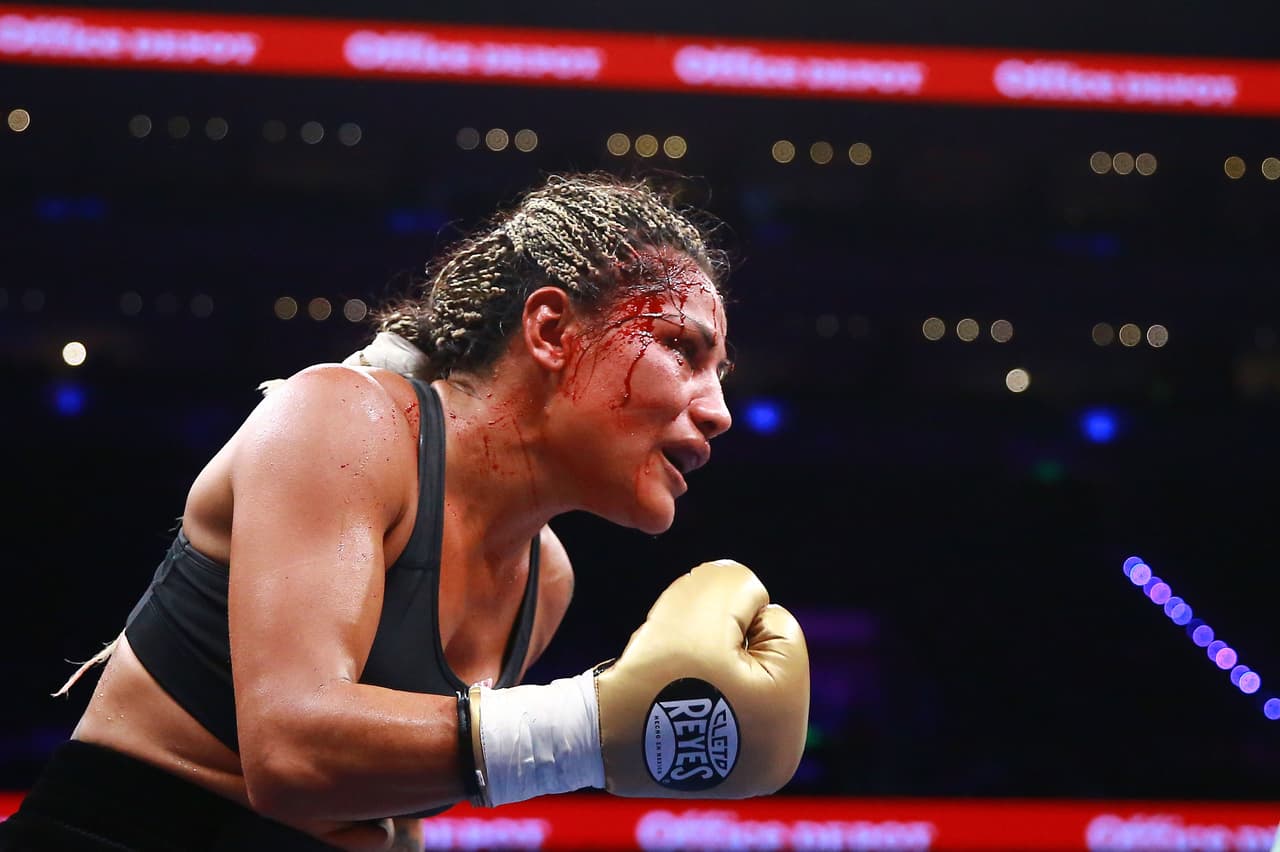Ciudad de México, 11 de agosto de 2018. Mariana Juarez , durante la función de Boxeo celebrado en la Nueva Arena Ciudad de México. Foto: Imago7/Eloisa Sanchez