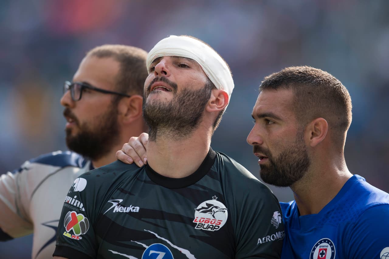 Minutos después, el arquero tuvo que abandonar el encuentro y en su lugar entró José Canales.