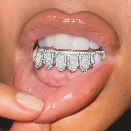 La parrilla dental está adornada con diamantes y piezas de ópalo.