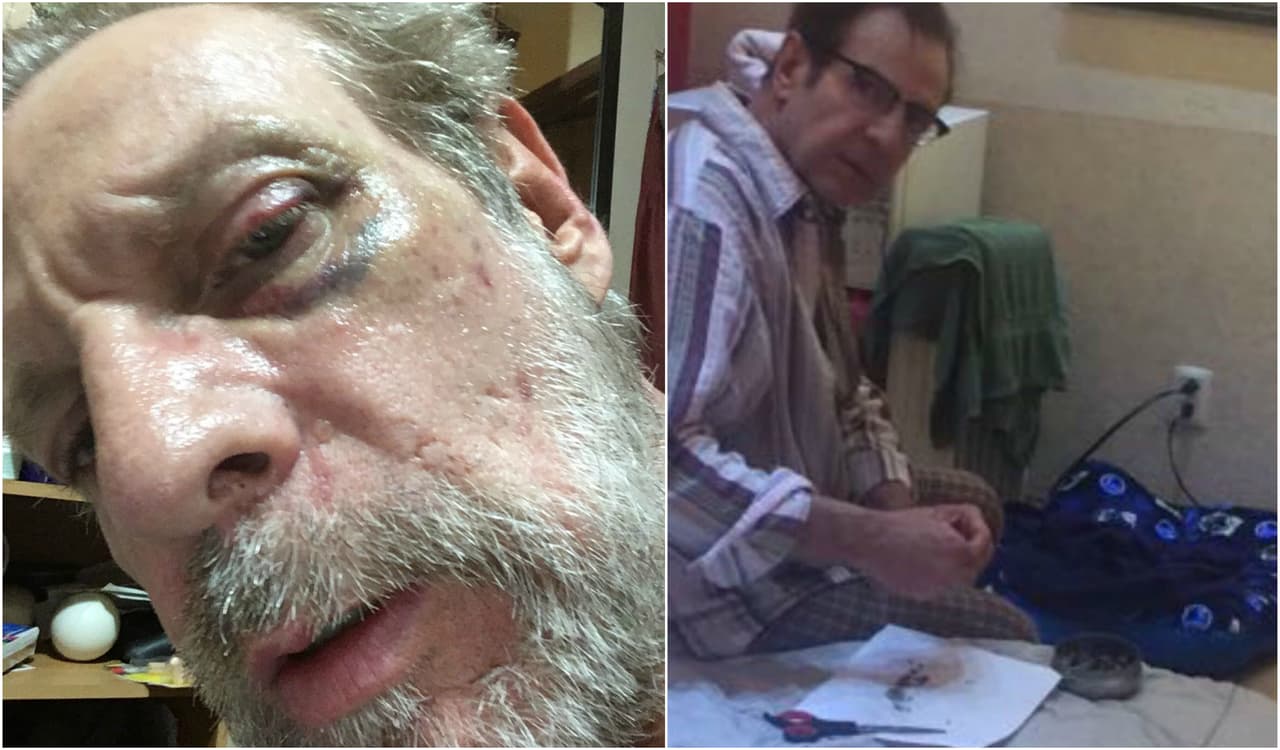 Uno de los casos más recientes fue el del actor mexicano Alejandro Tomassi, quien fue acusado por su pareja Oscar Ruiz de haberle tirado unos dientes por los golpes. Sin embargo, él mostró su rostro con golpes también.