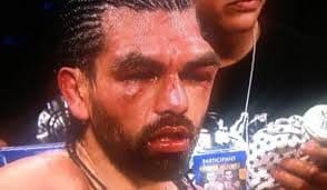 Terrorífica imagen de Alfredo 'Perro' Angulo (Foto: Twitter).