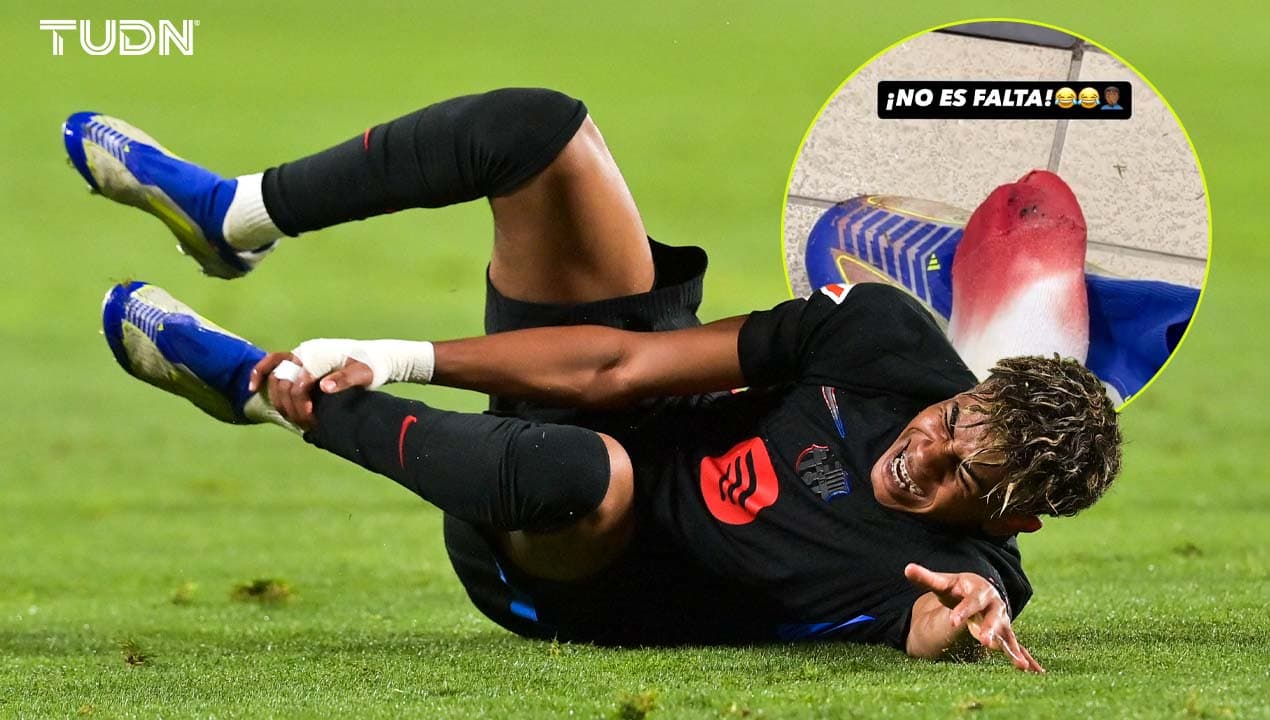 Lamine lanza mensaje al árbitro con pie bañado en sangre