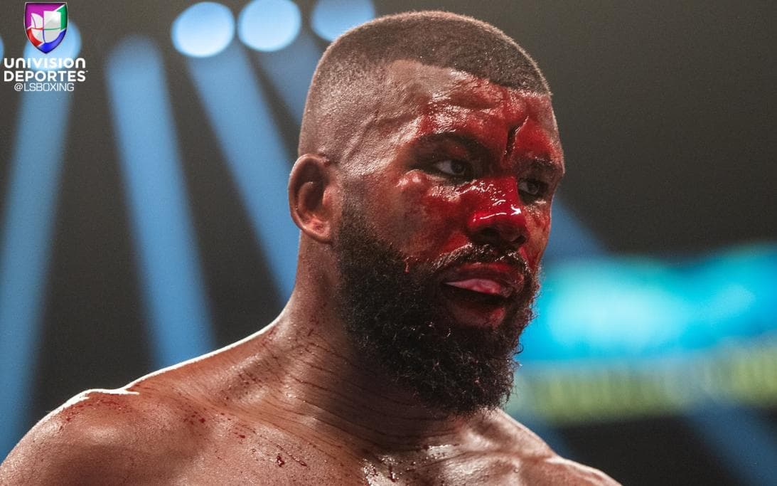 Badou Jack: "¿Qué es un corte en mi frente comparado con la vida de los niños refugiados?"