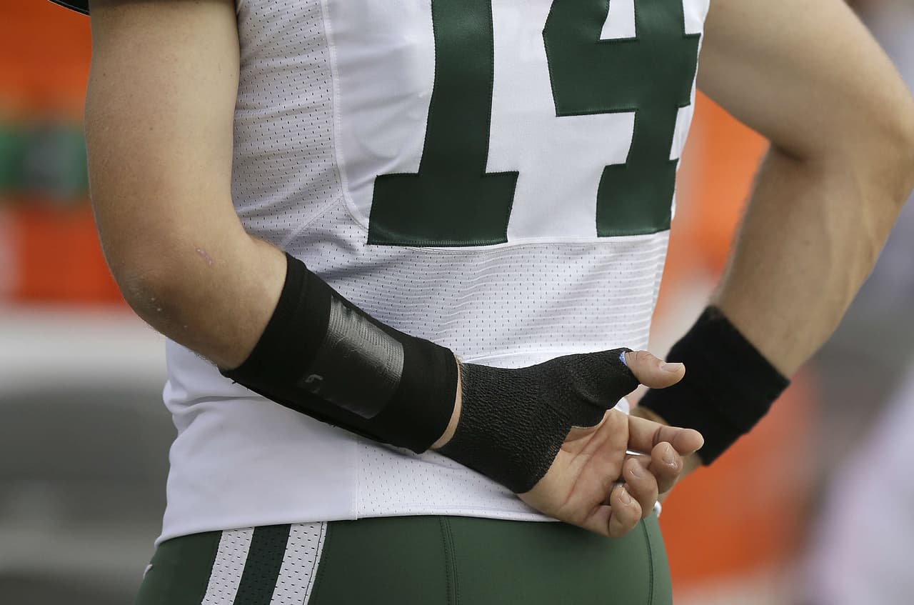 Ryan Fitzpatrick sufrió daño en el ligamento del dedo pulgar izquierdo