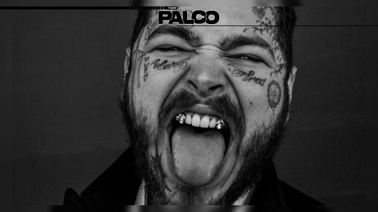 ¿Cuánto cuestan los millonarios colmillos de Post Malone? | El rapero estadounidense tuvo que mandar a cortar los diamantes para que le puedieran entrar en la boca.