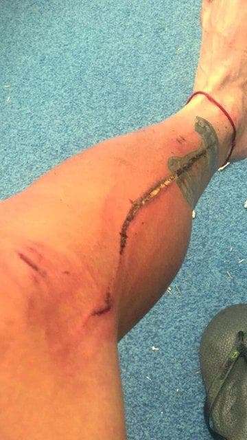 Después de un Atlas-Pumas, el uruguayo Egidio Arévalo Ríos quedó golpeado por una fuerte entrada. La que compartió la imagen fue su esposa.