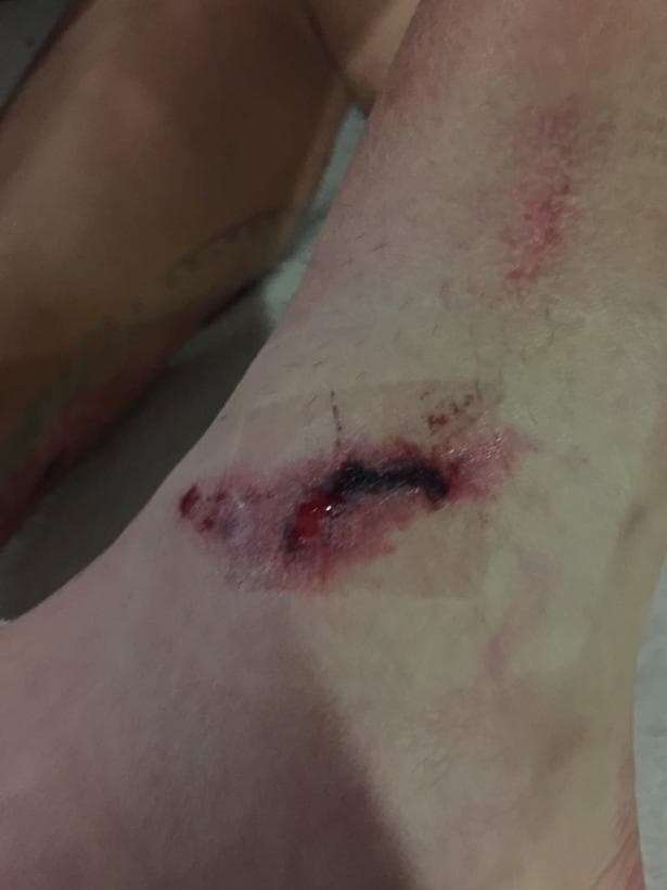 En el Clausura 2016 de la Liga MX a Rubens Sambueza le dejaron un recuerdito en el tobillo izquierdo. Una entrada de Wálter Kanemann le dejó así el pie.