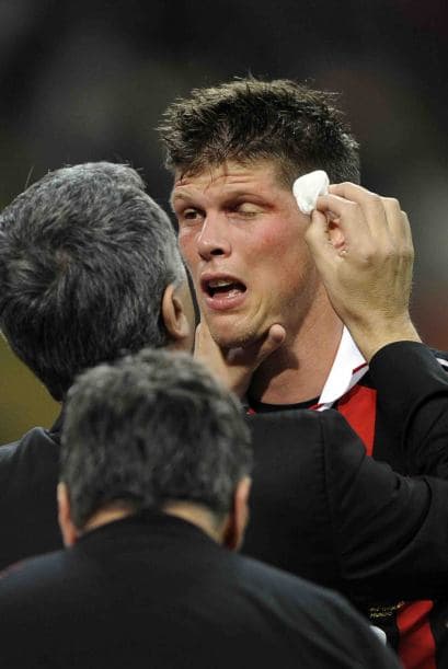 Así de peleado estuvo el encuentro, Klaas-Jan Huntelaar tuvo que atenderse un golpe en el rostro.