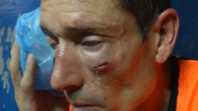 Guillermo Marconi, presidente del Sindicato de Árbitros Deportivos de la República Argentina, informó a la opinión pública que todos los colegiados se ausentarían de todas las categorías del fútbol argentino por un fin de semana.