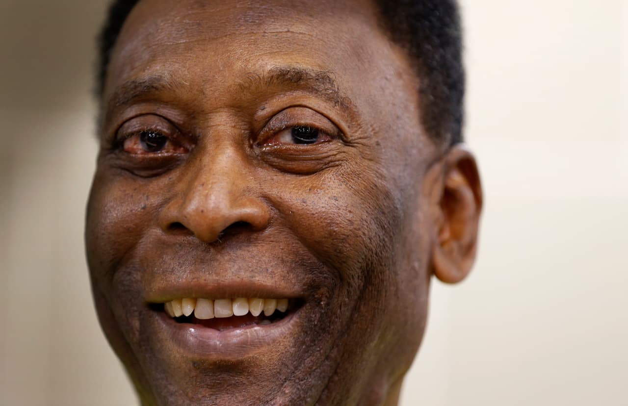 Pelé mejora de la infección respiratoria, pero aún no le dan alta médica