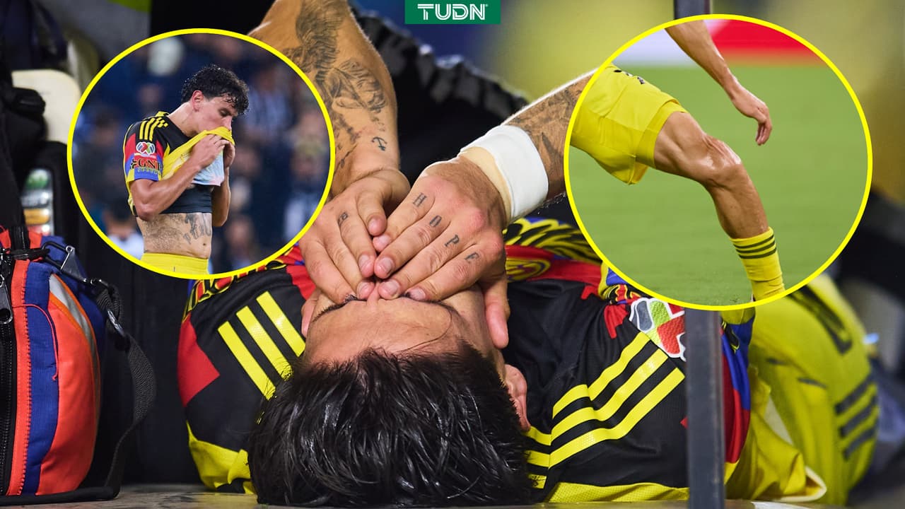 Víctor Dávila se suma a racha de lesionados de gravedad en América desde el 2023 