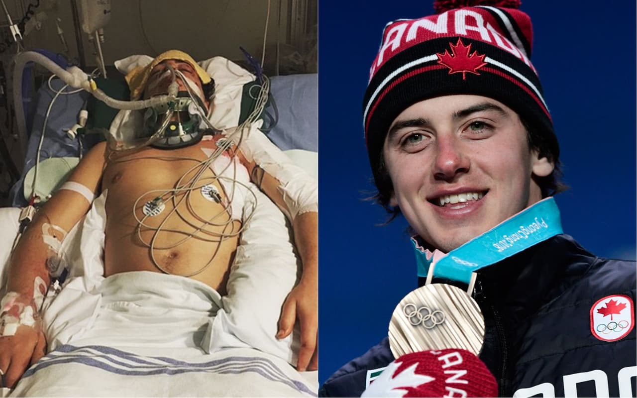 El canadiense Mark McMorris se convirtió en un ejemplo de superación en Pyeongchang 2018 al obtener una medalla de bronce poco tiempo después de dejar atrás un accidente que por poco cobra su vida.