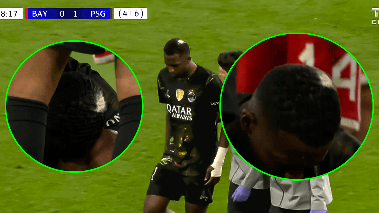 Willian Pacho es atendido de una lesión con 'polvito' mágico del PSG