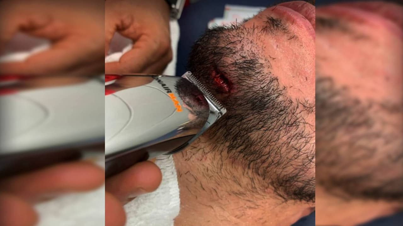 Chuy Molina presume corte tras encontronazo ante América