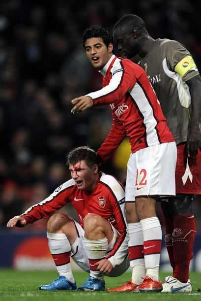 La pasó mal Arshavin que se rompió la cabeza en un choque con un contrario.