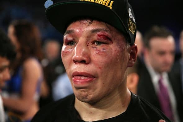 Así terminó el rostro de Provodnikov.