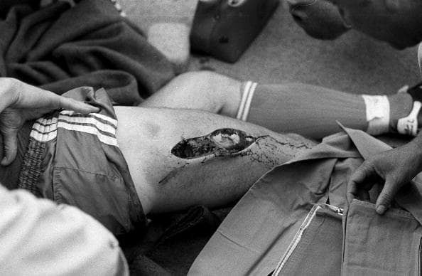 No hubo fractura, pero este corte de Ewald Lienen en un partido de la Bundesliga, sin duda hace estremecer.