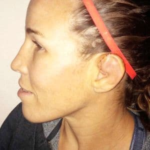 Leslie Smith se recupera de la lesión en la oreja