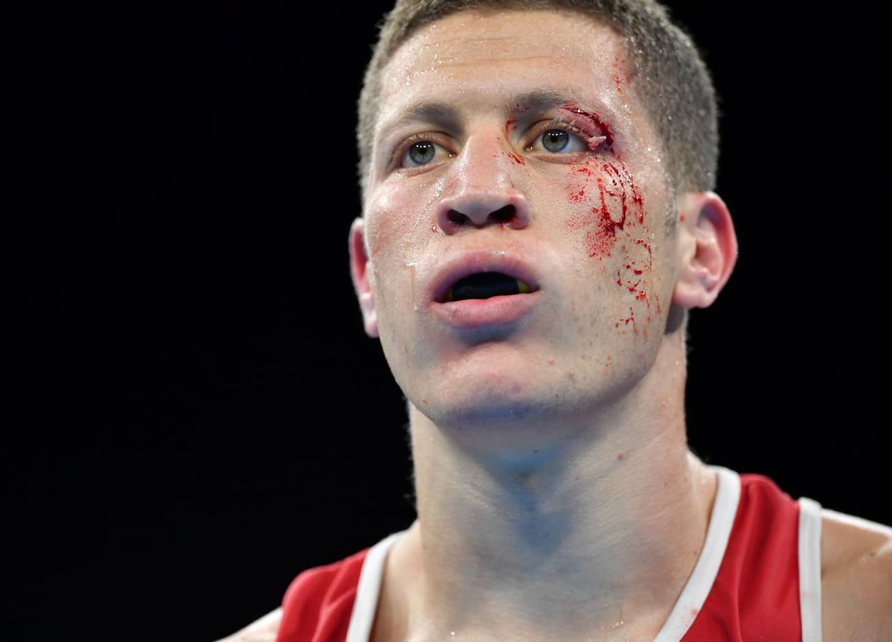 En el boxeo olímpico se acabó el uso de las caretas y eso ya tiene consecuencias.