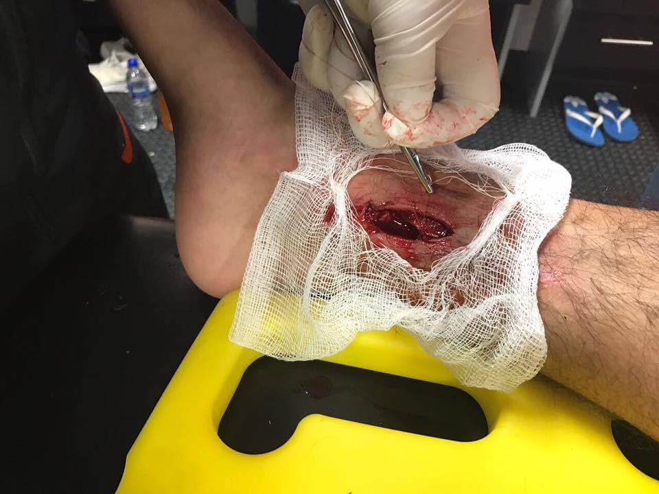 Esta no la subió ningún jugador, sino el Pachuca cuando el Chucky jugaba para ellos. Fue después de un juego ante Xolos en el que Hirving Lozano resultó herido.