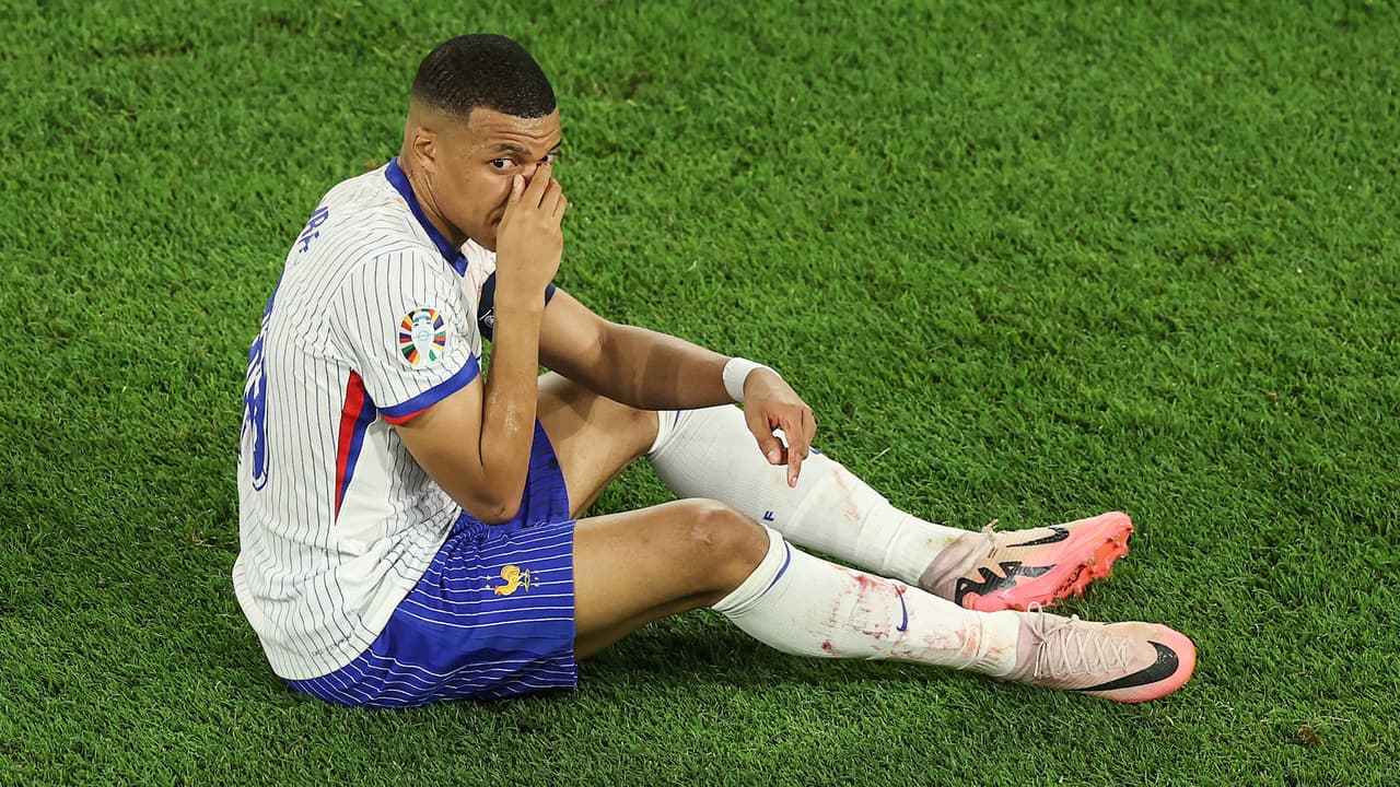 Kylian Mbappé toma con humor fractura de nariz y pide sugerencias