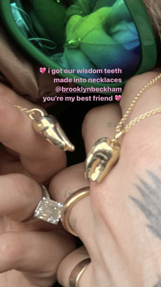 “He convertido nuestras muelas del juicio en collares @brooklynbeckham eres mi mejor amigo”, se lee en la captura tomada del Instagram de Peltz.
