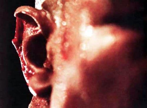 La oreja de Holyfield después de la mordida del 'caníbal' Mike Tyson (Foto: Twitter).