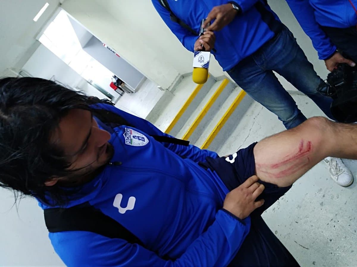 <b>Lo peor: </b>con una entrada imprudente, William Da Silva le dejó un 'recuerdito' al 'burrito' Hernández en la pierna, lo que le costó la roja al brasileño.