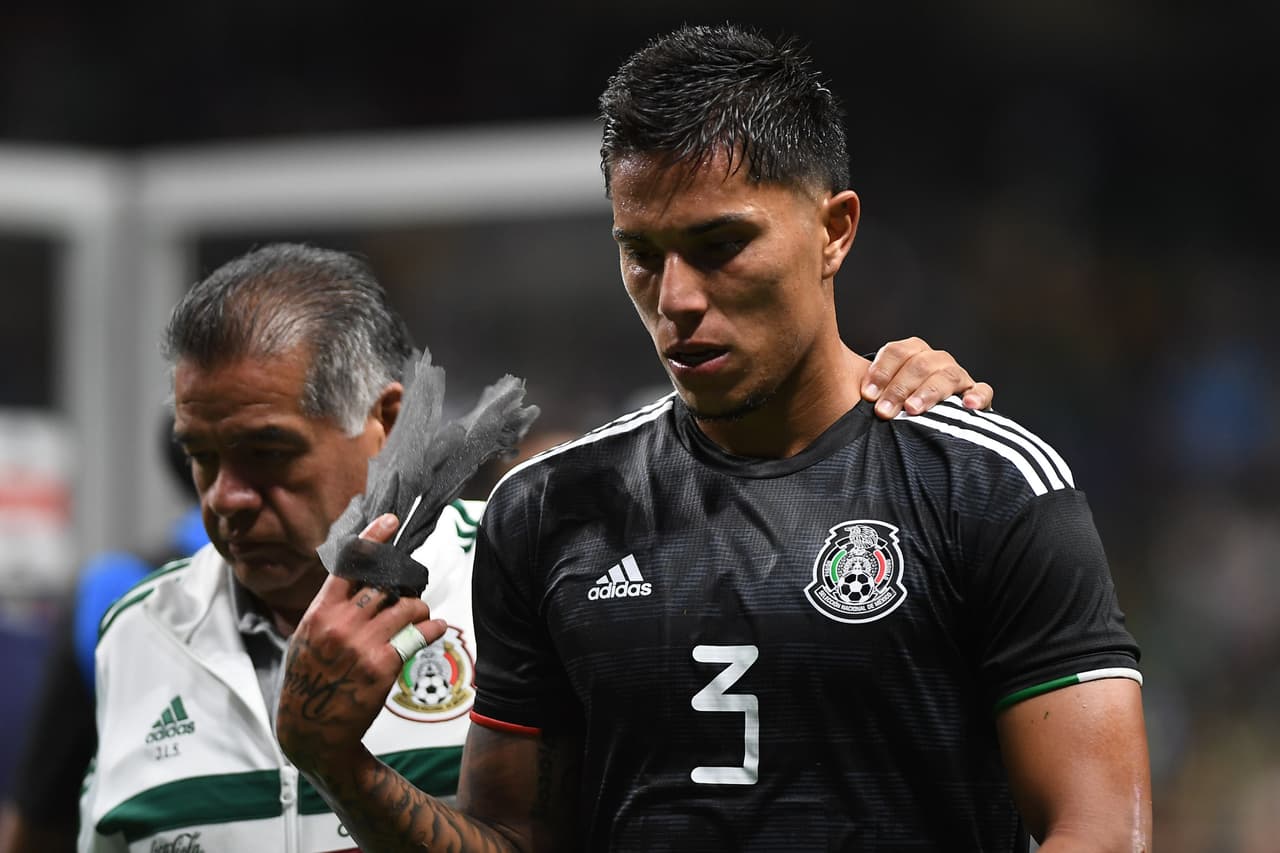 Salcedo: “Duele pero deja un aprendizaje”