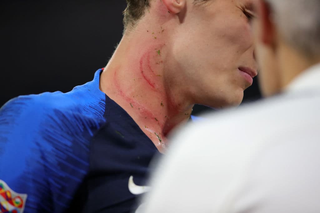 Lo cierto es que jugadores como Bernard Pavard sintieron ese espíritu aguerrido en propia piel, en un pisotón de Antonio Rudiger.