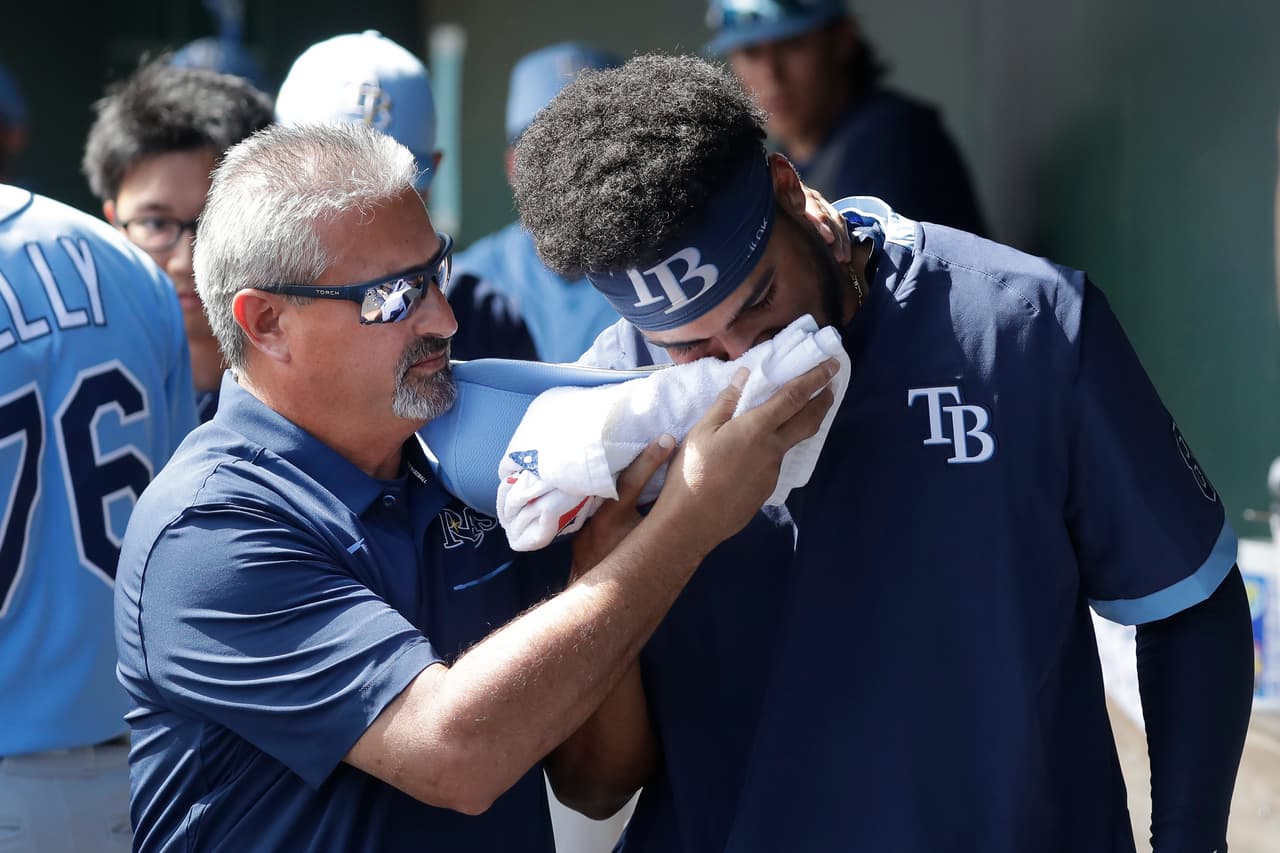 Prospecto de los Rays recibe pelotazo y sufre múltiples fracturas