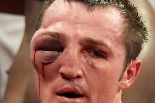 Alexander Lebedev y su cara poco 'agraciada' (Foto: Twitter).